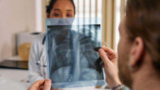 Rehabilitación pulmonar en Monterrey: cómo recuperar la respiración y la calidad de vida